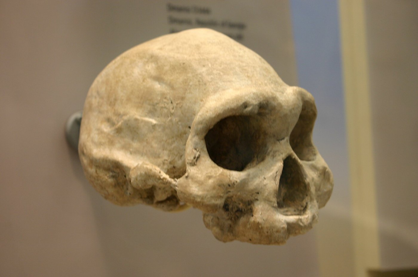 The Dmanisi skull D3444, belonging to an elderly individual who had lost nearly all of their teeth before death