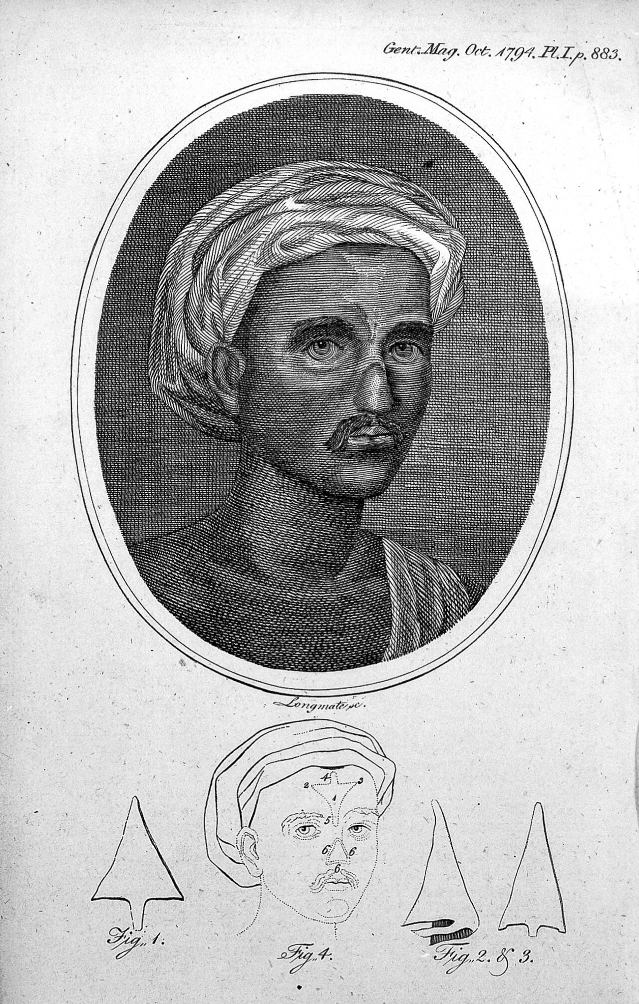 A later illustration of the Indian method of restoring the nose
